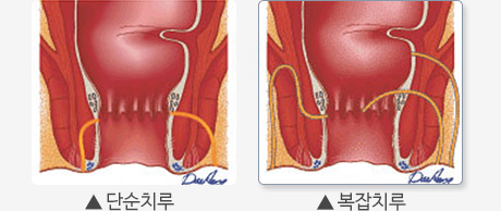 �躯����