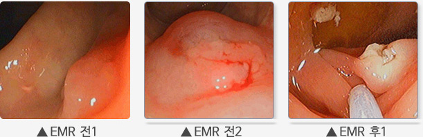 EMR